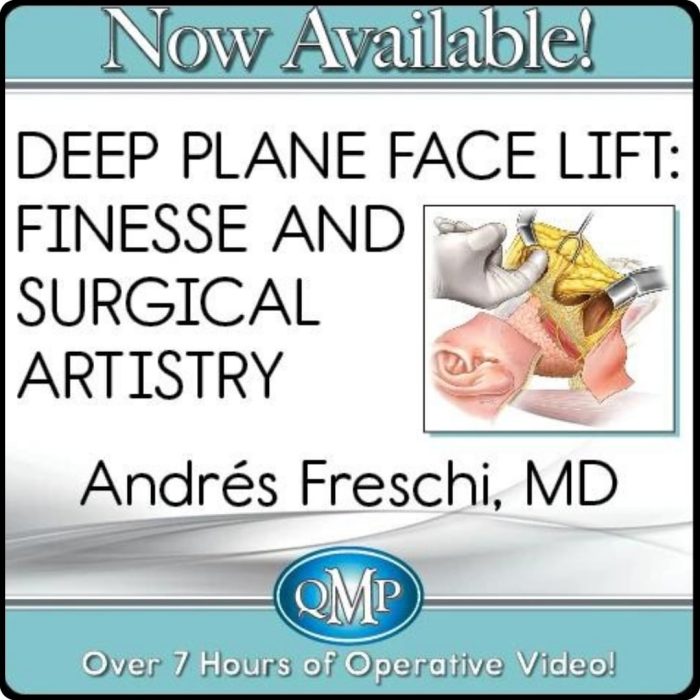 Deep Plane Face Lift: Finesse and Surgical Artistry 2023 QMP